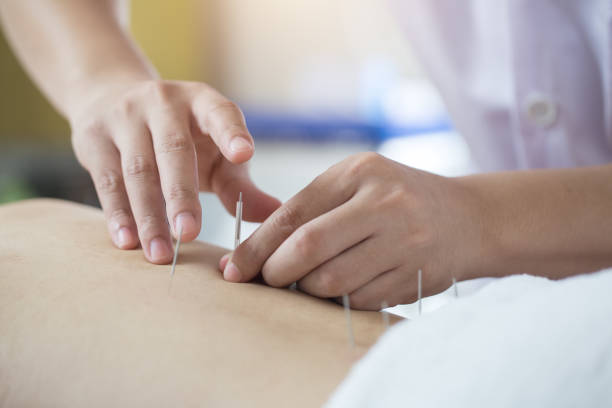 Comprehensive Acupuncture | Liang Yi TCM