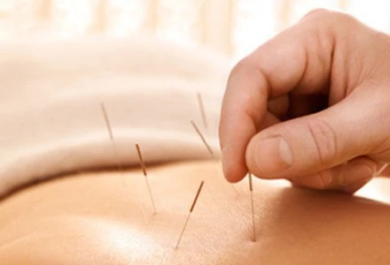 Slimming Acupuncture | Liang Yi TCM