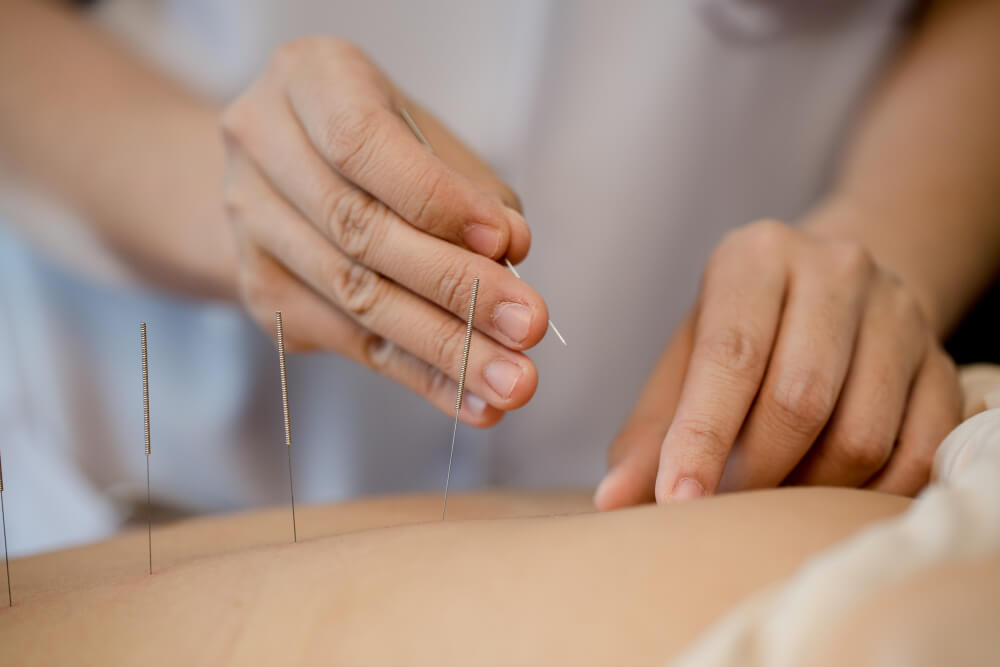 tcm acupuncture treaments to treat knee and back pain