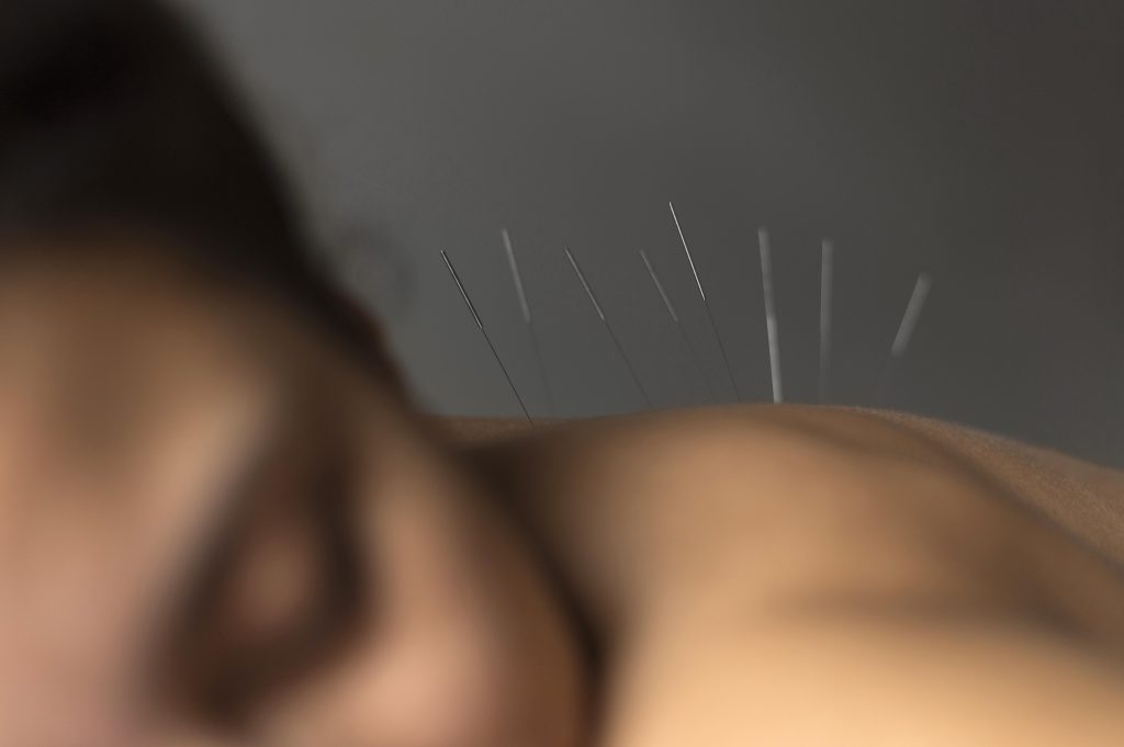 tcm back pain singapore